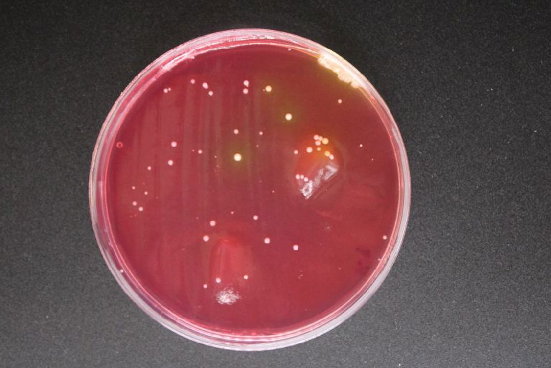 Car key bacteria.